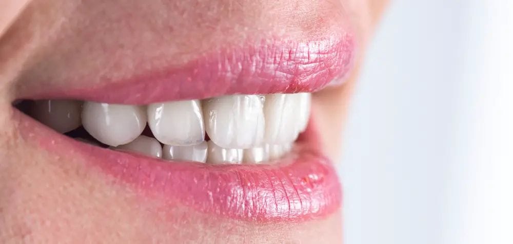 A2 Teeth Color: What Is It And How Is It Achieved