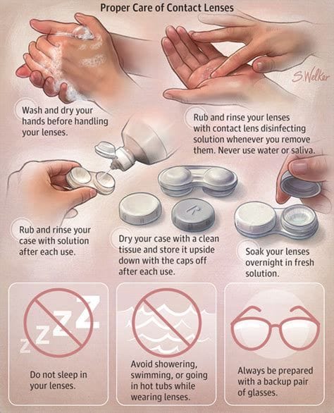 How to Care for Pure White Eye Contact Lenses